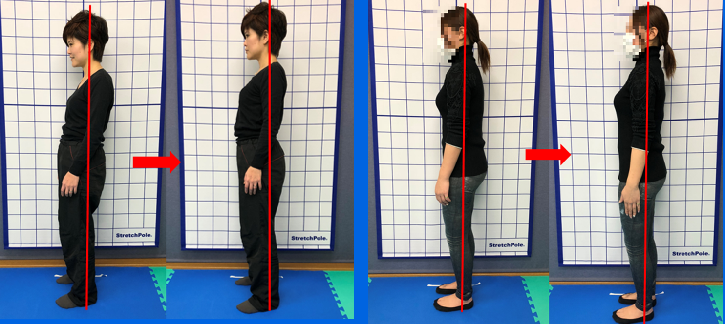 肩こり、腰痛、膝痛が改善する理由その２ 姿勢改善